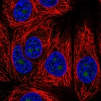 Immunofluorescent staining of human cell line MCF7 shows localization to nucleoli.