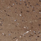 Immunohistochemical staining of human cerebral cortex shows high expression.
