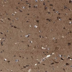 Immunohistochemical staining of human cerebral cortex shows high expression.