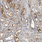 Immunohistochemical staining of human kidney shows strong extracellular space positivity in cells in tubules.