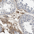 Immunohistochemical staining of human testis shows strong extracellular space positivity in Leydig cells.