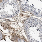 Immunohistochemical staining of human testis shows strong extracellular space positivity in Leydig cells.