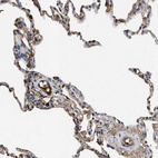 Immunohistochemical staining of human lung shows strong extracellular space positivity in macrophages.