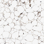 Immunohistochemical staining of human adipose tissue shows moderate extracellular space positivity in adipocytes.