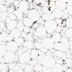 Immunohistochemical staining of human adipose tissue shows moderate extracellular space positivity in adipocytes.