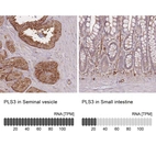 Anti-PLS3 Antibody