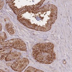 Immunohistochemical staining of human seminal vesicle shows high expression.