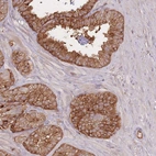 Immunohistochemical staining of human seminal vesicle shows high expression.