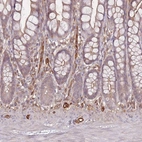 Immunohistochemical staining of human small intestine shows low expression as expected.