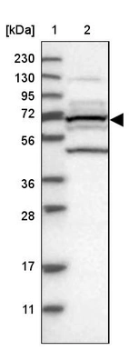 Lane 1: Marker [kDa] 230, 130, 95, 72, 56, 36, 28, 17, 11_br/_Lane 2: Human cell line RT-4