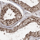Anti-ZNF839 Antibody