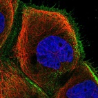 Immunofluorescent staining of human cell line A-431 shows localization to plasma membrane.