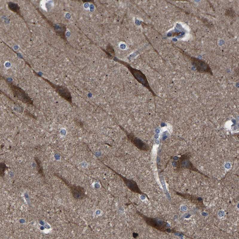 Anti-PAK5 Antibody