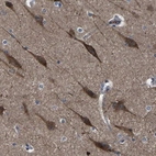 Anti-PAK5 Antibody