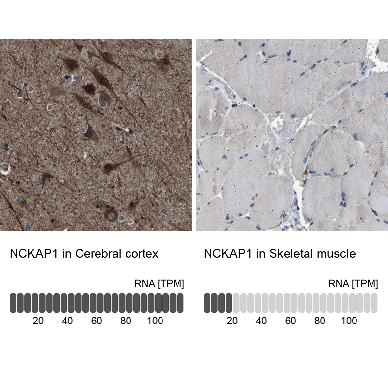 Anti-NCKAP1 Antibody