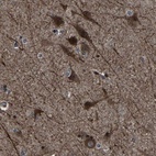 Immunohistochemical staining of human cerebral cortex shows high expression.