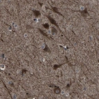 Immunohistochemical staining of human cerebral cortex shows high expression.