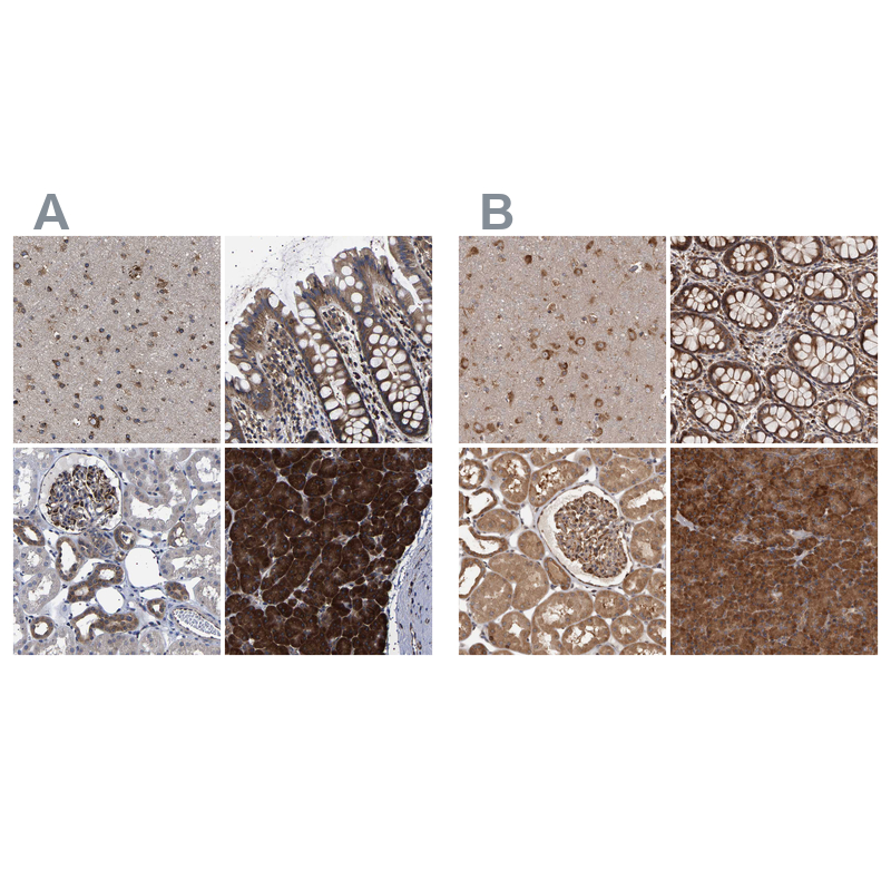 Rabbit Polyclonal Anti-DARS Antibody - Buy for research - Highly ...