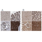Anti-DARS Antibody