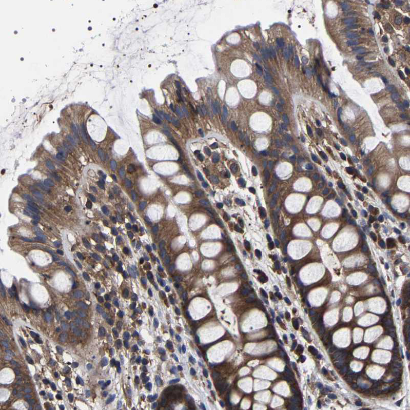 Rabbit Polyclonal Anti-DARS Antibody - Buy for research - Highly ...