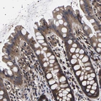 Immunohistochemical staining of human gastrointestinal shows strong cytoplasmic positivity in glandular cells.
