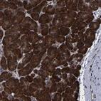 Immunohistochemical staining of human pancreas shows strong cytoplasmic positivity in glandular cells.