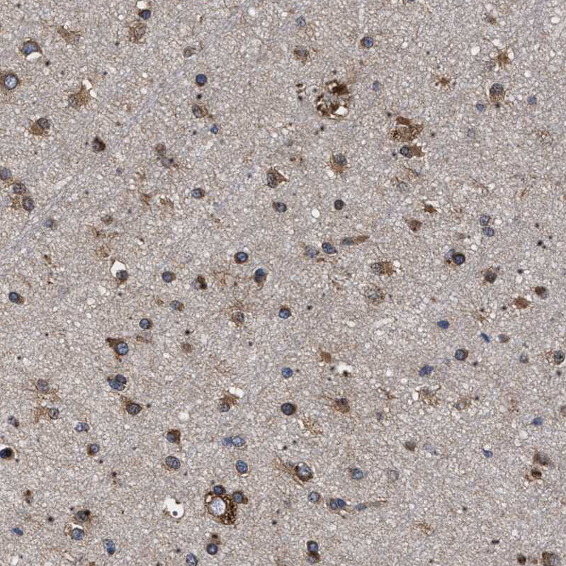 Rabbit Polyclonal Anti-DARS Antibody - Buy for research - Highly ...