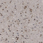 Immunohistochemical staining of human cerebral cortex shows strong cytoplasmic positivity in neuronal cells.