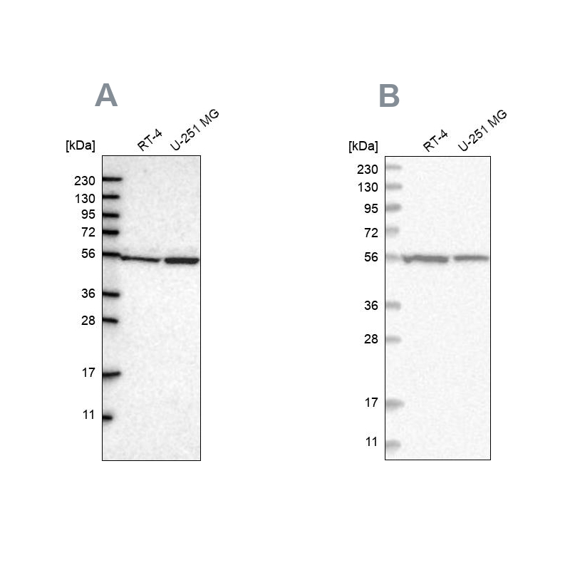 Rabbit Polyclonal Anti-DARS Antibody - Buy for research - Highly ...