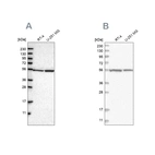 Western blot analysis using Anti-DARS antibody HPA020451 (A) shows similar pattern to independent antibody HPA029804 (B).