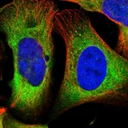 Immunofluorescent staining of human cell line U-2 OS shows localization to cytosol.