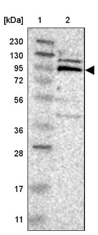 Lane 1: Marker [kDa] 230, 130, 95, 72, 56, 36, 28, 17, 11_br/_Lane 2: Human cell line RT-4