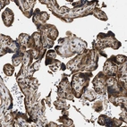 Immunohistochemical staining of human placenta shows strong cytoplasmic positivity in trophoblastic cells.