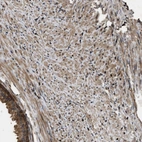 Immunohistochemical staining of human prostate shows weak cytoplasmic positivity in smooth muscle cells.