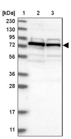 Lane 1: Marker [kDa] 230, 130, 95, 72, 56, 36, 28, 17, 11_br/_Lane 2: Human cell line RT-4_br/_Lane 3: Human cell line U-251MG sp