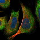 Immunofluorescent staining of human cell line U-2 OS shows localization to cytosol.