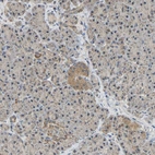 Anti-GCAT Antibody