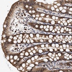 Anti-KLHDC1 Antibody