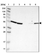 Lane 1: Marker [kDa] 230, 130, 95, 72, 56, 36, 28, 17, 11_br/_Lane 2: Human cell line RT-4_br/_Lane 3: Human cell line U-251MG sp_br/_Lane 4: Human plasma (IgG/HSA depleted)_br/_Lane 5: Human liver tissue_br/_Lane 6: Human tonsil tissue