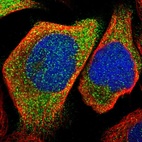 Immunofluorescent staining of human cell line A-431 shows localization to cytosol.