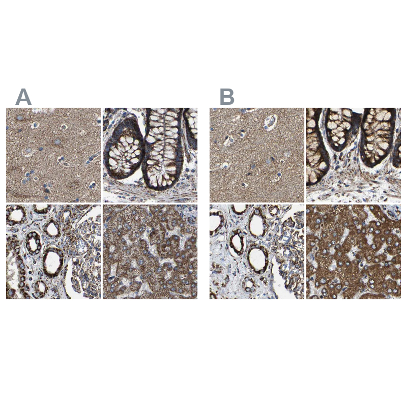 Anti-NDUFV3 Antibody