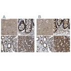 Anti-NDUFV3 Antibody