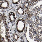 Immunohistochemical staining of human kidney using Anti-NDUFV3 antibody HPA020463.