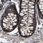 Immunohistochemical staining of human colon using Anti-NDUFV3 antibody HPA020463.
