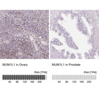 Anti-MUM1L1 Antibody