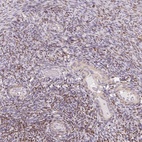 Anti-MUM1L1 Antibody