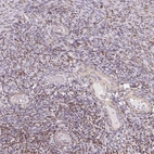 Immunohistochemical staining of human ovary shows high expression.