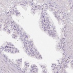 Anti-MUM1L1 Antibody