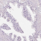 Immunohistochemical staining of human prostate shows low expression as expected.