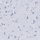 Anti-LRRC8E Antibody
